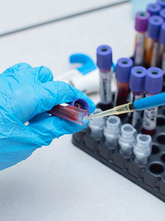 Abteilung für Innere Medizin und HämatoOnkologie LKH Hochsteiermark